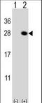 Quinoid Dihydropteridine Reductase antibody, LS-C162348, Lifespan Biosciences, Western Blot image 
