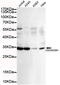 Cyclin Dependent Kinase 1 antibody, TA346908, Origene, Western Blot image 
