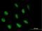 Abl interactor 2 antibody, H00010152-B01P, Novus Biologicals, Immunocytochemistry image 
