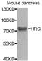 Histidine-rich glycoprotein antibody, A8431, ABclonal Technology, Western Blot image 