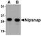 Protein NipSnap homolog 1 antibody, orb74963, Biorbyt, Western Blot image 