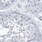 CSNK antibody, NBP2-58781, Novus Biologicals, Immunohistochemistry paraffin image 