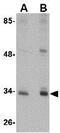 CUE domain-containing protein 2 antibody, GTX31363, GeneTex, Western Blot image 