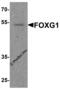 Forkhead Box G1 antibody, 8089, ProSci, Western Blot image 