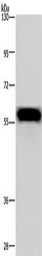 Fibrinogen beta chain antibody, TA349987, Origene, Western Blot image 