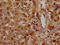 Solute Carrier Family 6 Member 11 antibody, LS-C680513, Lifespan Biosciences, Immunohistochemistry paraffin image 