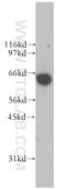 Polypyrimidine Tract Binding Protein 1 antibody, 12582-1-AP, Proteintech Group, Western Blot image 