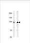 Zinc Finger Protein 560 antibody, TA328134, Origene, Western Blot image 