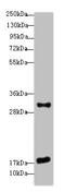 Epithelial Membrane Protein 3 antibody, A62470-100, Epigentek, Western Blot image 