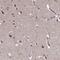 Disco Interacting Protein 2 Homolog B antibody, HPA046133, Atlas Antibodies, Immunohistochemistry frozen image 
