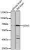 Potassium Voltage-Gated Channel Subfamily J Member 3 antibody, 23-925, ProSci, Western Blot image 