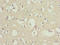 Oligodendrocyte Myelin Glycoprotein antibody, LS-C676207, Lifespan Biosciences, Immunohistochemistry paraffin image 