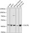 Calcitonin Receptor Like Receptor antibody, GTX64616, GeneTex, Western Blot image 