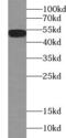 Estrogen Receptor 2 antibody, FNab02866, FineTest, Western Blot image 
