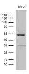 TNF Superfamily Member 10 antibody, M00466, Boster Biological Technology, Western Blot image 