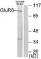 Metabotropic glutamate receptor 6 antibody, A06163-1, Boster Biological Technology, Western Blot image 