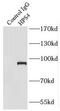 HPS4 Biogenesis Of Lysosomal Organelles Complex 3 Subunit 2 antibody, FNab04000, FineTest, Immunoprecipitation image 