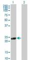 Regulator of G-protein signaling 5 antibody, TA337089, Origene, Western Blot image 