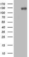 Phosphatidate phosphatase LPIN1 antibody, CF805973, Origene, Western Blot image 