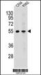 Melanin Concentrating Hormone Receptor 1 antibody, 55-342, ProSci, Western Blot image 