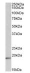 Ubiquitin Conjugating Enzyme E2 C antibody, orb12989, Biorbyt, Western Blot image 