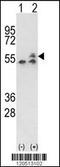 ATP Synthase F1 Subunit Beta antibody, 61-625, ProSci, Western Blot image 