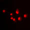 Hdm2 antibody, LS-C352508, Lifespan Biosciences, Immunofluorescence image 