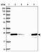 Metabolism Of Cobalamin Associated B antibody, PA5-58628, Invitrogen Antibodies, Western Blot image 