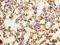 Major Facilitator Superfamily Domain Containing 11 antibody, A62958-100, Epigentek, Immunohistochemistry paraffin image 