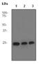 CD9 Molecule antibody, ab92726, Abcam, Western Blot image 