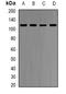 3-Hydroxy-3-Methylglutaryl-CoA Reductase antibody, LS-B16059, Lifespan Biosciences, Western Blot image 