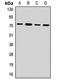 Phosphoenolpyruvate Carboxykinase 2, Mitochondrial antibody, orb412735, Biorbyt, Western Blot image 