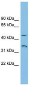 Rh Family B Glycoprotein (Gene/Pseudogene) antibody, TA338416, Origene, Western Blot image 