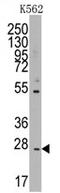 CD8b Molecule antibody, AP11413PU-N, Origene, Western Blot image 