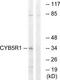 NADH-cytochrome b5 reductase 1 antibody, TA312378, Origene, Western Blot image 
