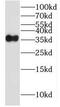 Linker For Activation Of T Cells antibody, FNab04706, FineTest, Western Blot image 