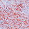 Desmin antibody, LS-C88137, Lifespan Biosciences, Immunohistochemistry paraffin image 