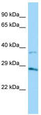 Aldo-Keto Reductase Family 1 Member B15 antibody, TA332216, Origene, Western Blot image 