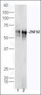 Zinc Finger Protein 92 antibody, orb186541, Biorbyt, Western Blot image 