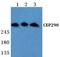Centrosomal protein of 290 kDa antibody, PA5-36580, Invitrogen Antibodies, Western Blot image 