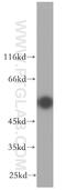 Ectonucleoside Triphosphate Diphosphohydrolase 8 antibody, 18848-1-AP, Proteintech Group, Western Blot image 