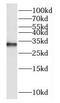 Dual Specificity Phosphatase 15 antibody, FNab02565, FineTest, Western Blot image 