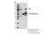 FES Proto-Oncogene, Tyrosine Kinase antibody, 85704S, Cell Signaling Technology, Immunoprecipitation image 