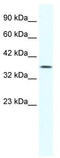 Y-Box Binding Protein 2 antibody, TA335578, Origene, Western Blot image 