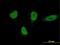 E3 ubiquitin-protein ligase RNF220 antibody, MA5-24470, Invitrogen Antibodies, Immunofluorescence image 