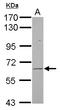 Frizzled Class Receptor 9 antibody, LS-C155173, Lifespan Biosciences, Western Blot image 