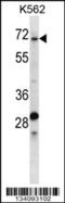 Thyroid Hormone Receptor Interactor 10 antibody, 57-672, ProSci, Western Blot image 