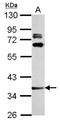 Lymphocyte Transmembrane Adaptor 1 antibody, NBP2-19335, Novus Biologicals, Western Blot image 