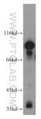 Serine/threonine-protein kinase MARK1 antibody, 21552-1-AP, Proteintech Group, Western Blot image 
