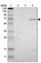Zinc Finger Protein 37A antibody, NBP1-81345, Novus Biologicals, Western Blot image 